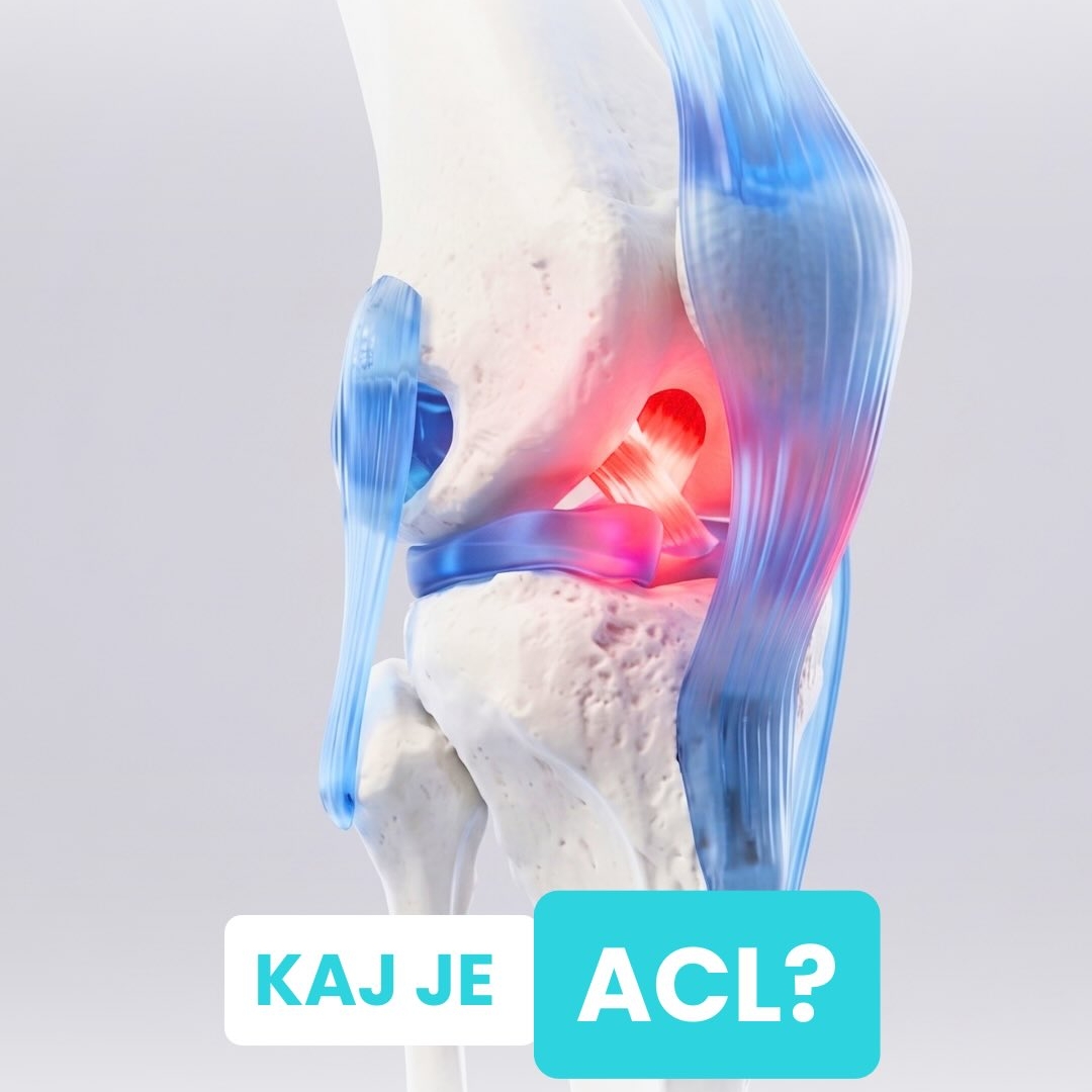 Kaj je ACL?👀

#dialab #sanatis #acl #poskodbakolena #diagnostika